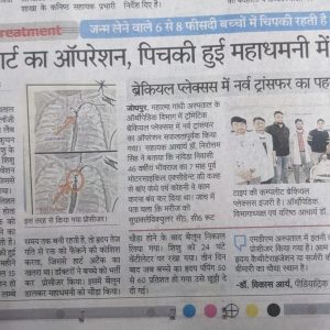 patrika coarctation